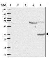 Anti-ST8SIA4 antibody produced in rabbit HPA051126-100UL