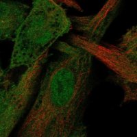 Anti-STAMBP antibody produced in rabbit 