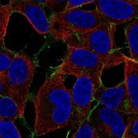 Anti-STARD4 antibody produced in rabbit