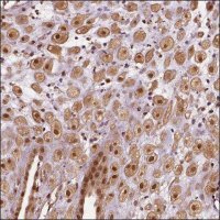 Anti-STAT3 antibody produced in rabbit HPA001671-100UL