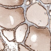 Anti-STC1 antibody produced in rabbit 