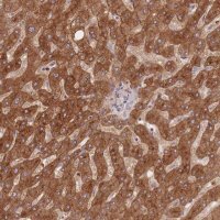 Anti-STEAP3 antibody produced in rabbit HPA050510-100UL