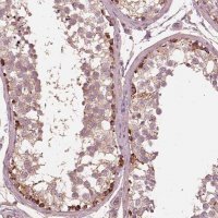 Anti-STK33 antibody produced in rabbit