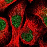 Anti-STK33 antibody produced in rabbit