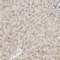 Anti-STOM antibody produced in rabbit 