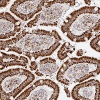Anti-STOML2 antibody produced in rabbit 