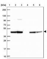 Anti-STOML2 antibody produced in rabbit 
