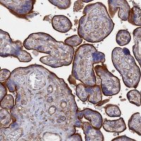 Anti-STRA6 antibody produced in rabbit 