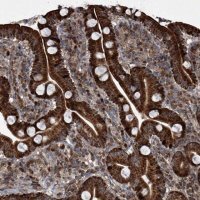 Anti-STRADA antibody produced in rabbit 