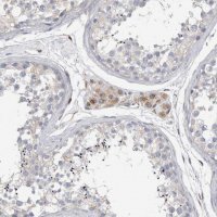 Anti-STRADB antibody produced in rabbit 