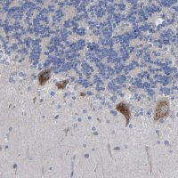 Anti-STRIP2 antibody produced in rabbit 