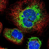 Anti-STT3B antibody produced in rabbit 