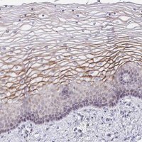 Anti-SUSD4 antibody produced in rabbit 