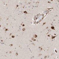 Anti-SUSD6 antibody produced in rabbit 