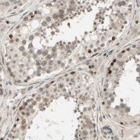 Anti-SVBP antibody produced in rabbit 