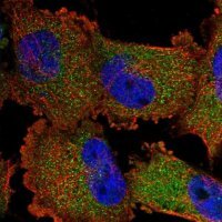 ANTI-SWT1 antibody produced in rabbit 
