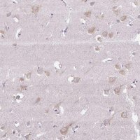 Anti-SYBU antibody produced in rabbit 
