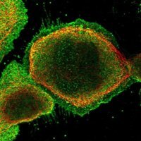 Anti-SYMPK antibody produced in rabbit 