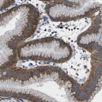 Anti-SYNGR2 antibody produced in rabbit 