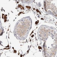Anti-SYTL5 antibody produced in rabbit HPA026074-100UL