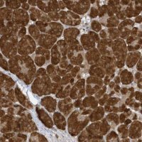 Anti-TAB3 antibody produced in rabbit 