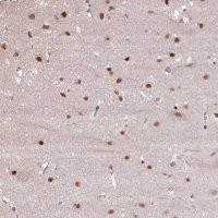 Anti-TAF1A antibody produced in rabbit 