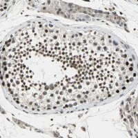 Anti-TAF6 antibody produced in rabbit HPA006566-100UL