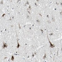 Anti-TAF6 antibody produced in rabbit HPA006566-100UL