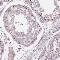 Anti-TAF6L antibody produced in rabbit