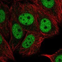 Anti-TAF6L antibody produced in rabbit