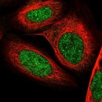 Anti-TAF8 antibody produced in rabbit 