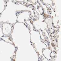 Anti-TAGLN2 antibody produced in rabbit HPA001925-100UL