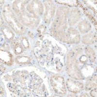 Anti-TAL2 antibody produced in rabbit 