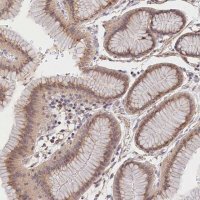 Anti-TANGO6 antibody produced in rabbit