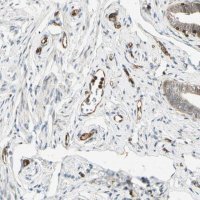 Anti-TAPBP antibody produced in rabbit 