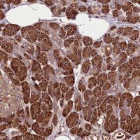 Anti-TARS antibody produced in rabbit 