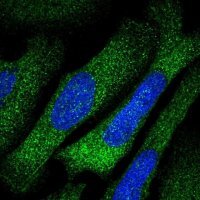 Anti-TARS antibody produced in rabbit 