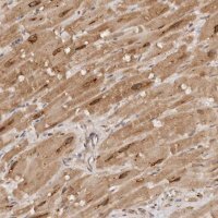 Anti-TARS2 antibody produced in rabbit 