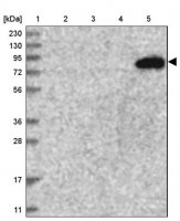 Anti-TATDN2 antibody produced in rabbit 