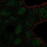 Anti-TBC1D10A antibody produced in rabbit HPA007725-100UL
