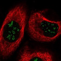 Anti-TBC1D13 antibody produced in rabbit
