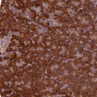 Anti-TBC1D19 antibody produced in rabbit 