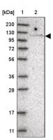 Anti-TBC1D2 antibody produced in rabbit HPA030871-100UL