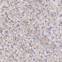Anti-TBC1D22A antibody produced in rabbit 
