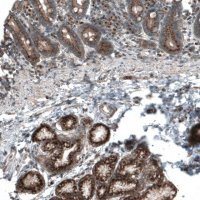 Anti-TBC1D23 antibody produced in rabbit