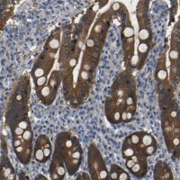 Anti-TBC1D32 antibody produced in rabbit HPA013413-100UL