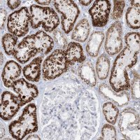 Anti-TBC1D7 antibody produced in rabbit 