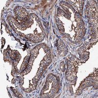 Anti-TBCEL antibody produced in rabbit