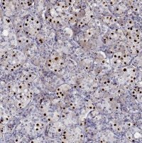 Anti-TBX19 antibody produced in rabbit