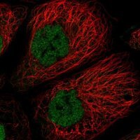 Anti-TCF20 antibody produced in rabbit 
